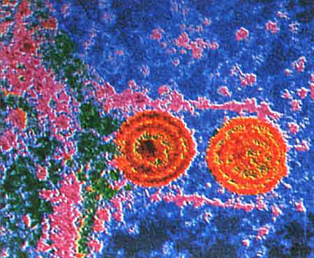 Herpes Simplex Virus. Picture of the Herpes 